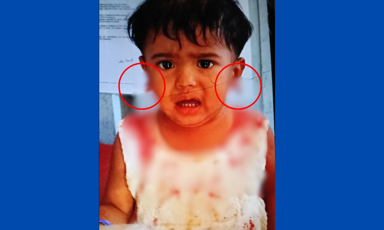 শিশুর কানের লতি ছিঁড়ে নিয়ে স্বর্ণের দুল ছিনতাই – দৈনিক আজাদী শিশুর কানের লতি ছিঁড়ে নিয়ে স্বর্ণের দুল ছিনতাই – দৈনিক আজাদী