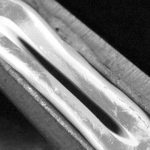 3d-printed-blood-vessel-u-e-1722088636