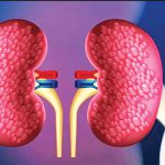 kidney–