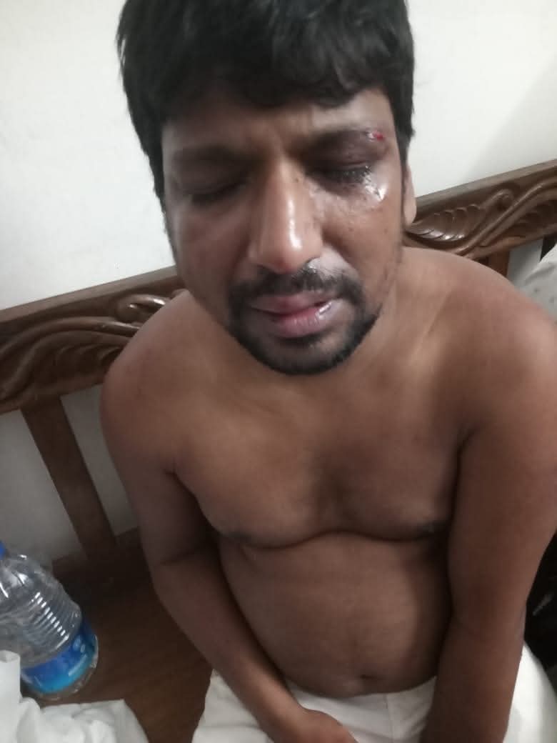 সন্দ্বীপে পিডিবির ঠিকাদারকে অপহরণ, চাঁদা দাবি ও মারধর – দৈনিক আজাদী