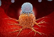 প্রাথমিক পর্যায়ে নির্ণয় হলে ক্যানসার নিরাময় বহুলাংশে সম্ভব