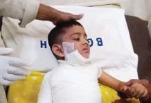 গরম পানির ডেকচিতে পড়ে দগ্ধ শিশুর মৃত্যু