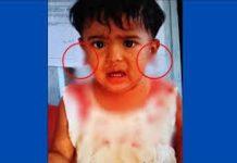 শিশুর কানের লতি ছিঁড়ে স্বর্ণের দুল ছিনতাই