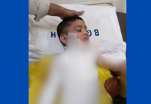 চন্দনাইশে গরম পানির ডেক্সিতে পড়ে শিশুর মৃত্যু