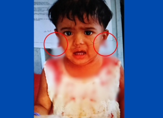 শিশুর কানের লতি ছিঁড়ে নিয়ে স্বর্ণের দুল ছিনতাই