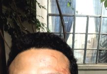 চাকসুর পাঠাগার সম্পাদকের ওপর হামলা