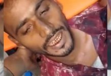 সাতকানিয়ায় দিনমজুরকে কুপিয়ে ও মারধর করে নগদ টাকা লুট