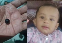 চট্টগ্রামে গলায় তসবিহর দানা আটকে শিশুর মৃত্যু