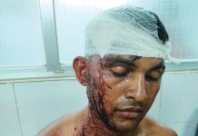 চকরিয়ায় বরফমিলে সন্ত্রাসীদের তাণ্ডব, ম্যানেজারকে কুপিয়ে জখম