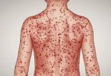 হটস্পটের তালিকায় বৃহত্তর চট্টগ্রামের রামু ও মহেশখালী