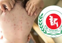 হামের উপসর্গ নিয়ে একদিনে ১১ জনের মৃত্যু