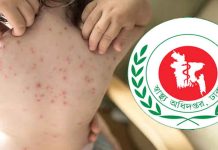 দেশে হাম ও উপসর্গ নিয়ে আরও ৭ শিশুর মৃত্যু