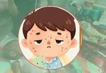 হামের উপসর্গ নিয়ে আরও ১৮ শিশু হাসপাতালে ভর্তি