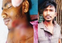 মীরসরাইয়ে যুবদলের দুই গ্রুপে সংঘর্ষ, আহত ১০