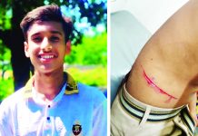 ফুটবল খেলা চলাকালে তরুণকে কুপিয়ে জখম কিশোর গ্যাংয়ের