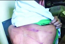 চন্দনাইশে শিক্ষার্থীকে মারধরের অভিযোগ শিক্ষকের বিরুদ্ধে