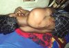 লোহাগাড়ায় দুই রিকশা চালক গুলিবিদ্ধ