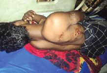 লোহাগাড়ায় দুই রিকশা চালক গুলিবিদ্ধ