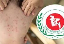 মারা গেছে আরো ৯ শিশু, মৃত্যু ৩৫০ ছাড়াল