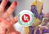 দেশে হাম ও উপসর্গ নিয়ে আরো ৭ মৃত্যু, নতুন শনাক্ত ১৫৫