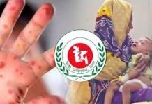 দেশে হাম ও উপসর্গ নিয়ে আরো ৭ মৃত্যু, নতুন শনাক্ত ১৫৫