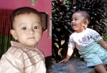 মীরসরাইয়ে হামের উপসর্গে যমজ দুই ভাইয়ের মৃত্যু