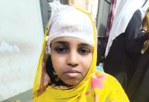 বোয়ালখালীতে হাতুড়ি দিয়ে স্ত্রীর মাথা ফাটালো স্বামী