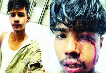 লোহাগাড়ায় ঈদের দিন দুই তরুণ গুলিবিদ্ধ