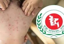 হাম ও উপসর্গ নিয়ে আরও ৪ শিশুর মৃত্যু
