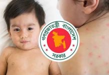 চট্টগ্রামে আরও ১১ শিশুর হাম শনাক্ত