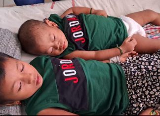 বান্দরবানে হামে আক্রান্ত দুই শিশু জানেনা তাদের মা আর নেই