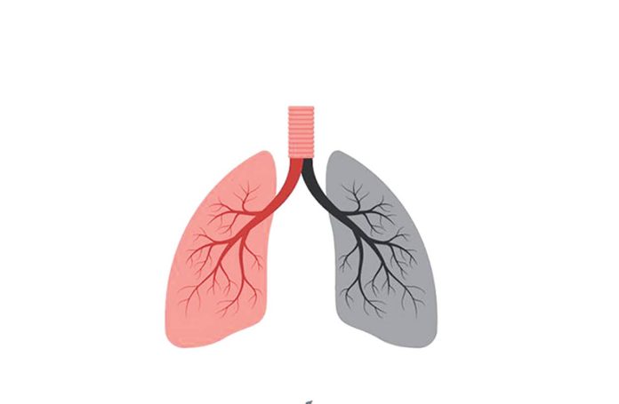 Lung