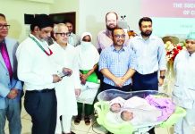 আলাদা করা হলো জন্মগতভাবে জোড়া লাগানো জমজ শিশুকে