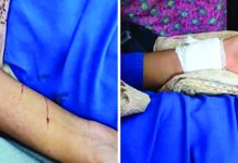 সীতাকুণ্ডে স্কুল ছাত্রীকে ছুরিকাঘাত করে ছিনিয়ে নিল স্বর্ণালংকার