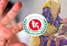 চট্টগ্রামে আরো ৩১ শিশু হাসপাতালে